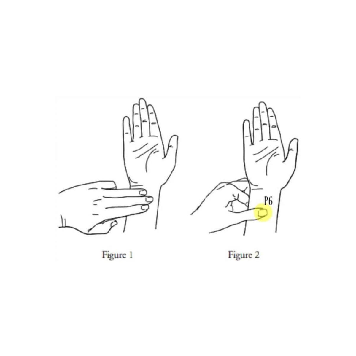 Mother Mother - Pregnancy Nausea Relief Bands (Acupressure Wristbands)